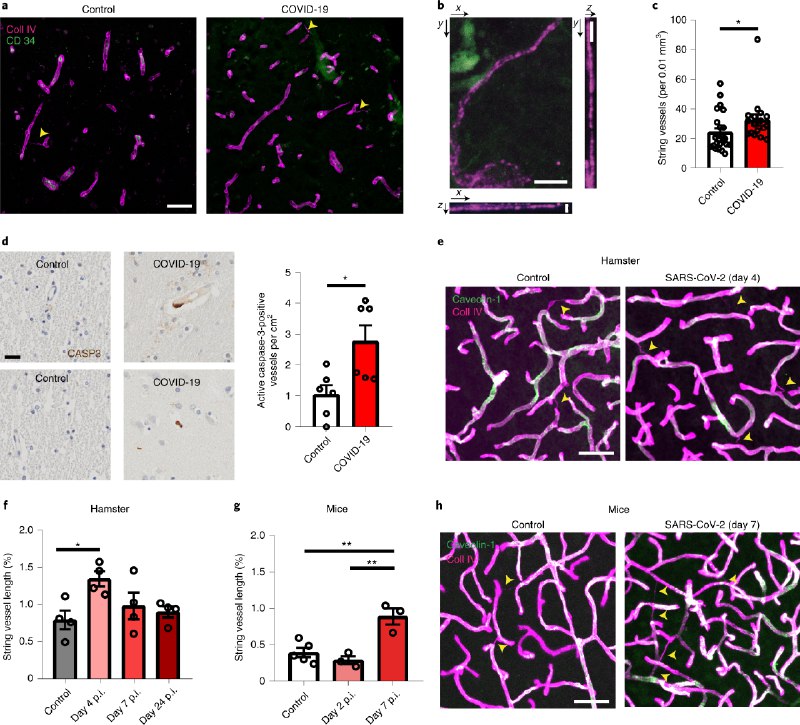 The SARS-CoV-2 main protease M [pro] causes microvascular brain pathology by cleaving NEMO in brain endothelial cells