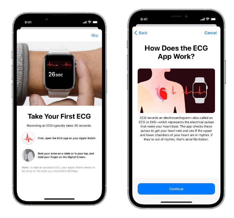 🫀中国大陆正式解锁 Apple Watch 的 ECG 心电图功能经过我的测试，正式确认中国大陆范围内已经解锁 Apple Watch 的 ECG (算法 v1)心电图功能，同时可以检测正常心率下的房颤
