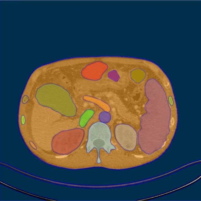 Meta 推出 Segment Anything 模型，不需要训练分割模型，输入什么图都能分割via Lecter🗒 标签: #Meta #AI #SegmentAnything 📢 频道: @GodlyNews1🤖 投稿: @GodlyNewsBot